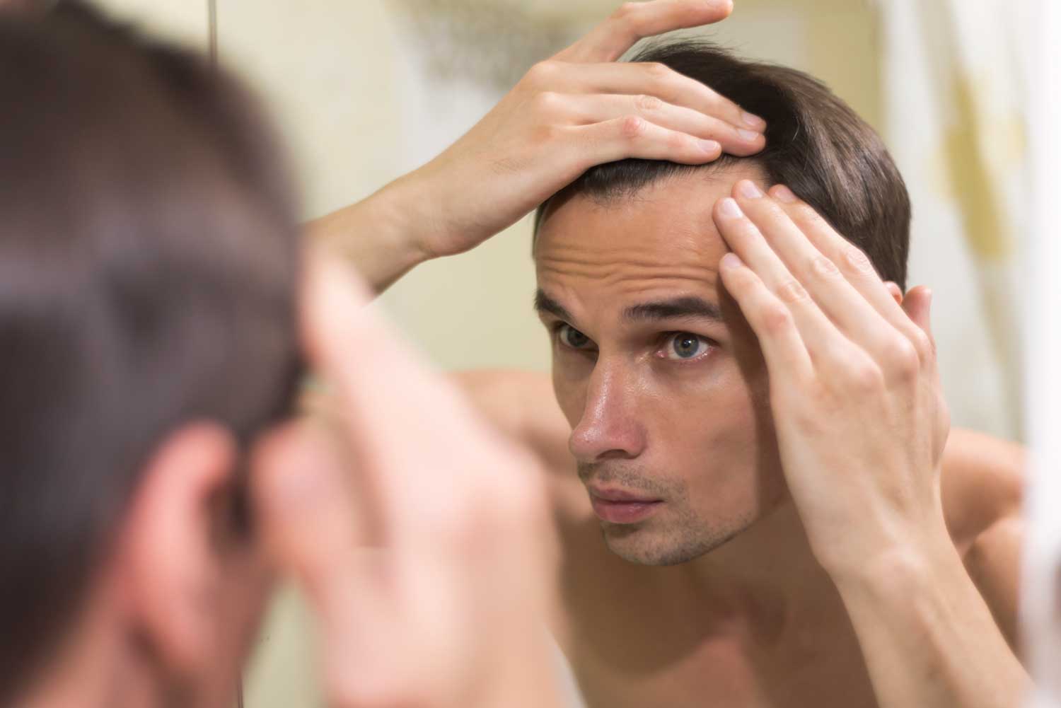 Understanding Hair Loss